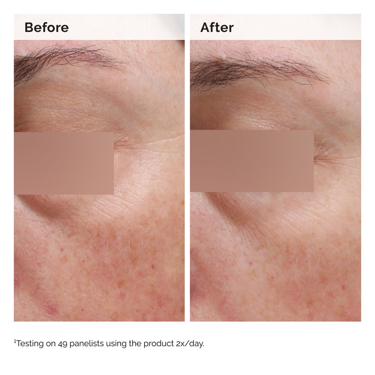 niacinamide-5-face-and-body-emulsion-m5 2024-08-23-ORD-Nia-5pct-Face-Body-B-A-Elasticity-Global-02-1x1.jpg
