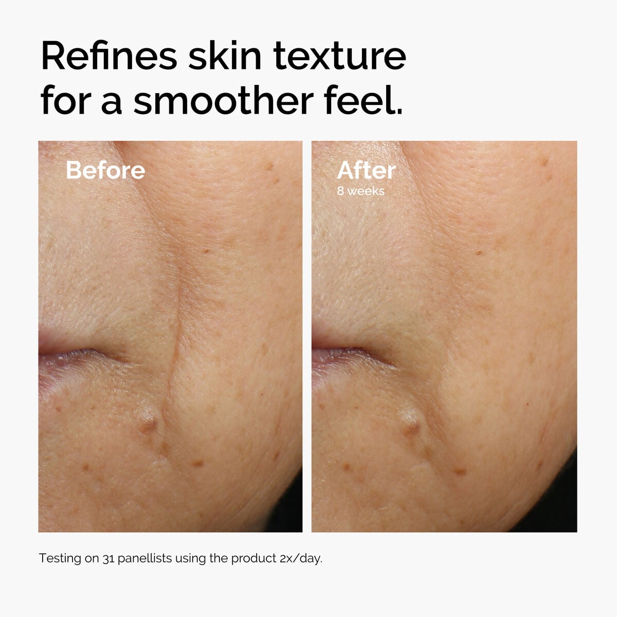 caffeine-3-escin-1-face-serum-f1 ord-caffeine-3pct-escin-1pct-face-serum-before-after-texture.jpg