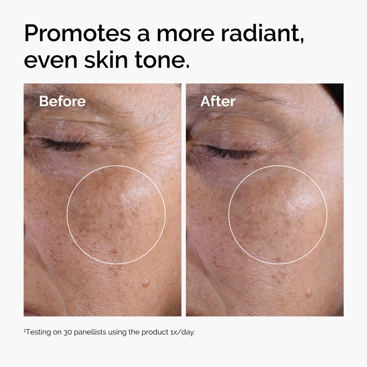 glycolic-acid-7-exfoliating-toner-o9 ord-glycolic-before-after-radiance.jpg