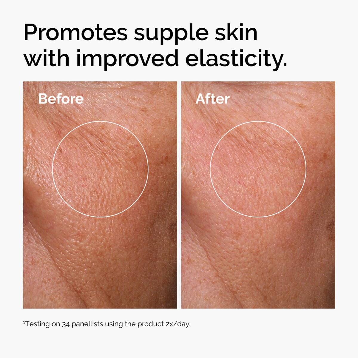 hyaluronic-acid-2-b5-with-ceramides-d1 ord-hyaluronic-acid-2pct-b5-hydrating-serum-before-after-elasticity.jpg