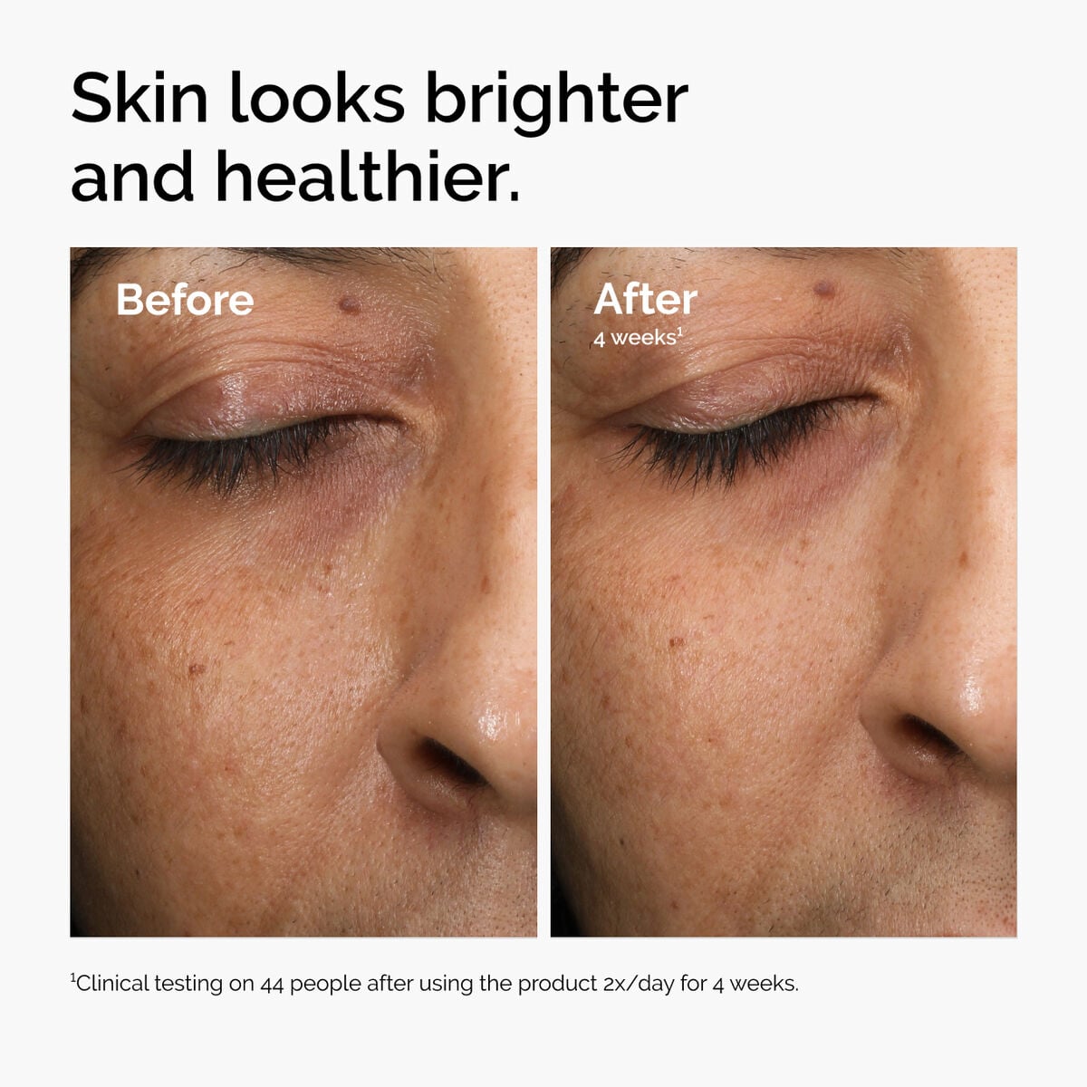 multi-antioxidant-radiance-serum-g2 ord-mars-before-after-healthy.jpg