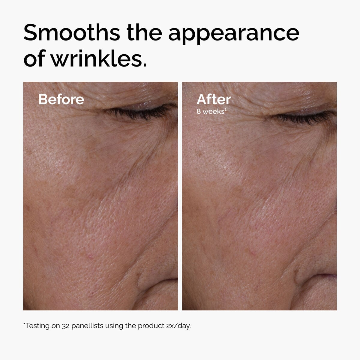 multi-peptide-ha-serum-v9 ord-multi-peptide-ha-serum-wrinkles-before-after.jpg