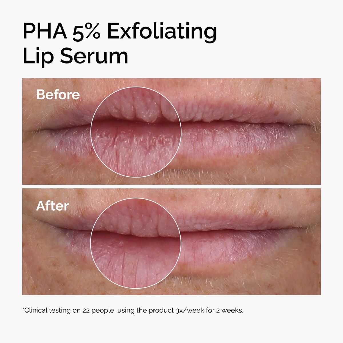 pha-5-exfoliating-lip-serum-j1 ord-pha-5pct-lip-exfoliating-serum-before-after.jpg