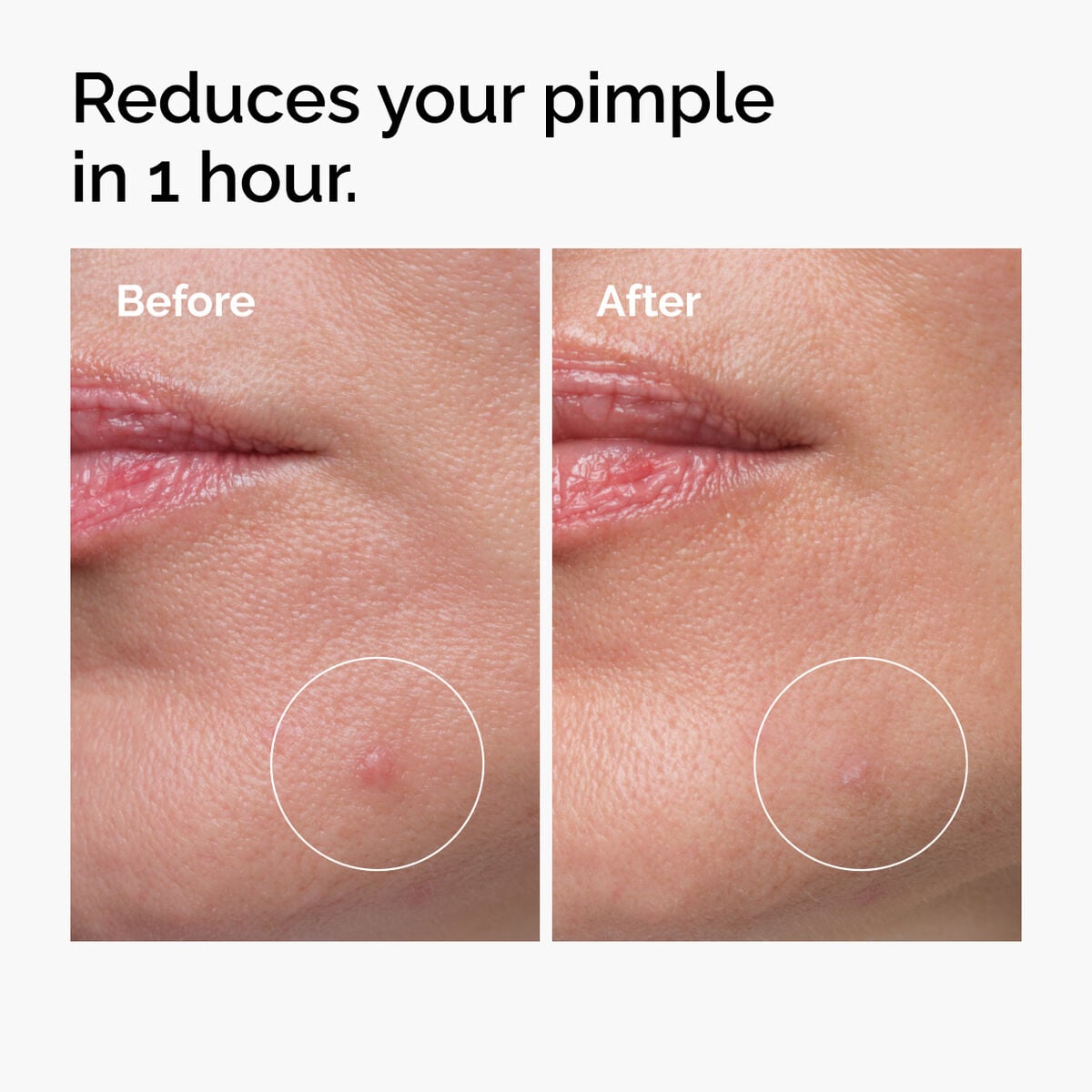 sulfur-10-powder-to-cream-concentrate-i5 ord-sulfur-10pct-powder-to-cream-concentrate-before-after-NA.jpg