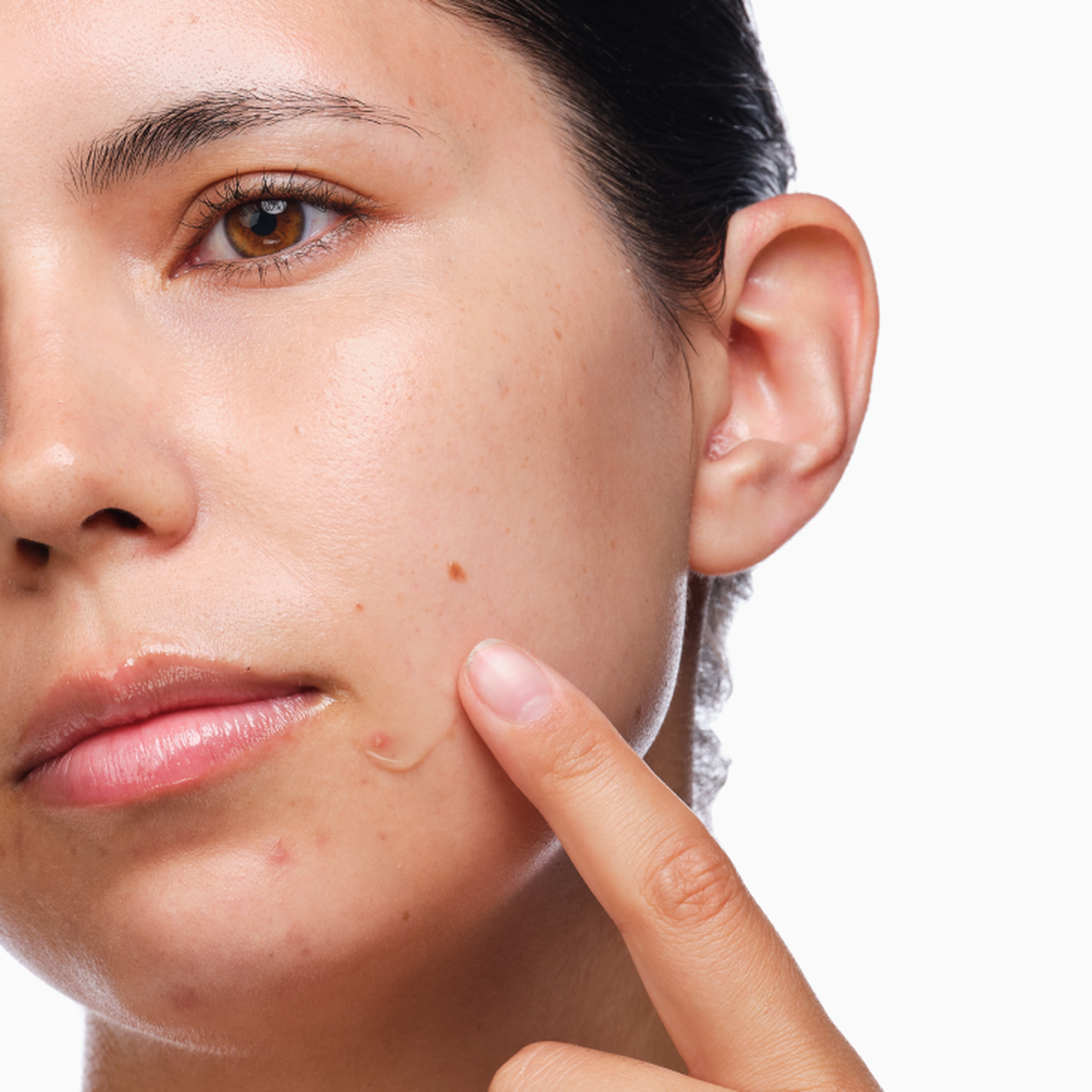 the-acne-set-w7 rdn-the-acne-set-application.png